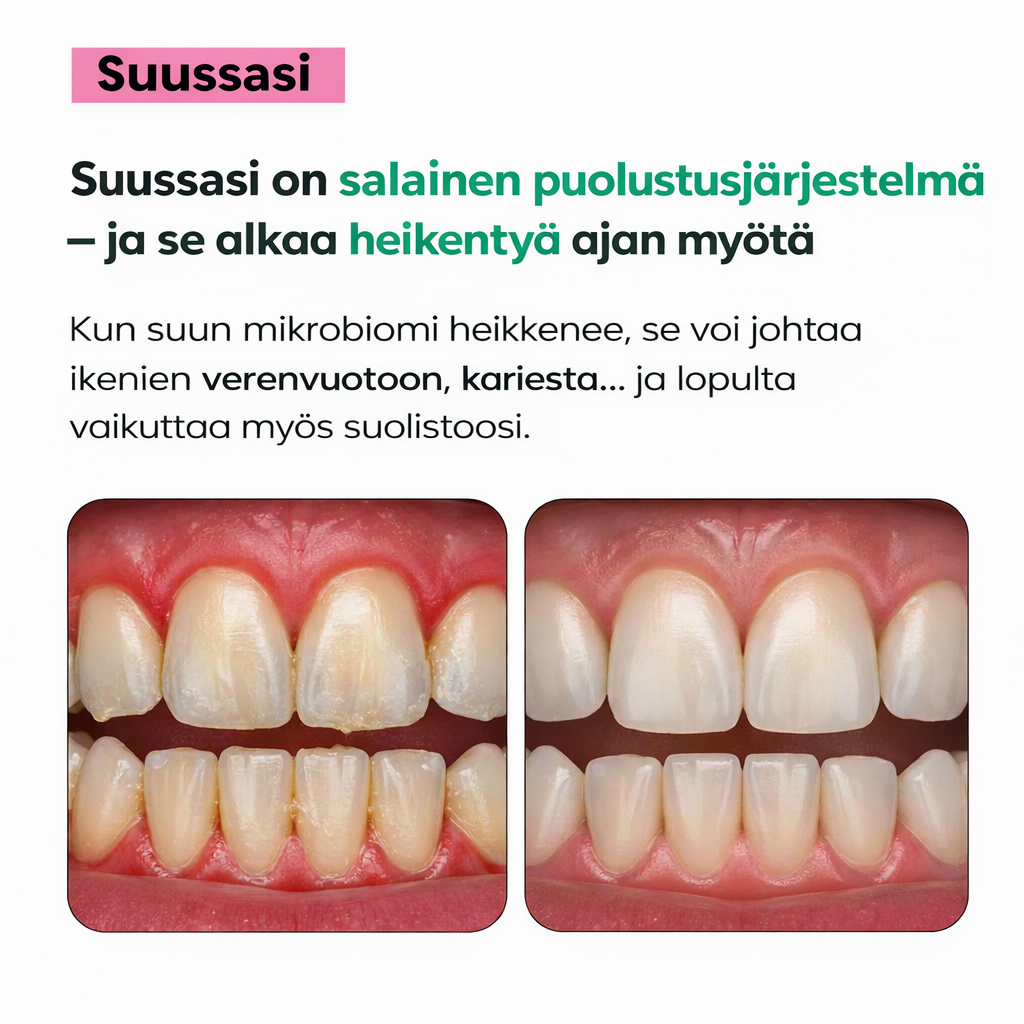 Oral Defence – Maksimaalinen teho suun mikrobiomin palauttamiseen